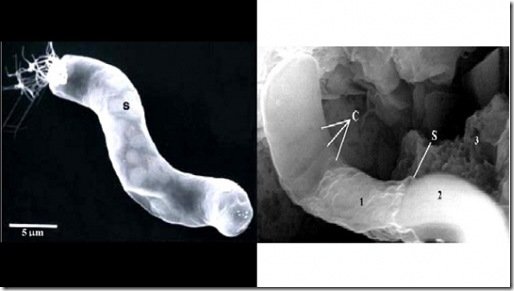 actual bacterium