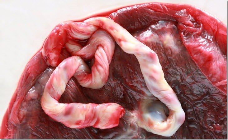 placenta