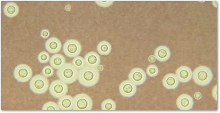 Cryptococcus neoformans